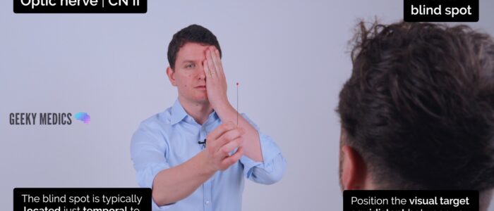Cranial nerve exam - Assess the patient's blind spot