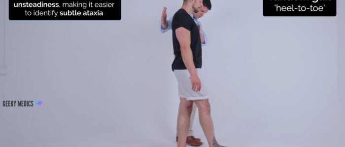 Lower limb neurological exam - Tandem (heel-to-toe) gait