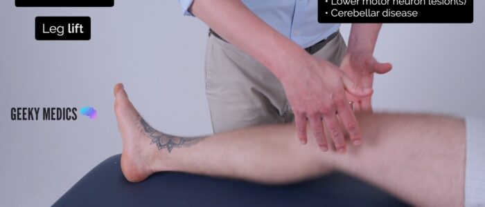 Lower limb neurological examination - Assess tone (leg lift)