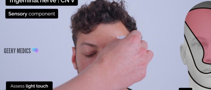 Cranial nerve exam - Assess light touch sensation (V1)