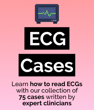 ECG cases