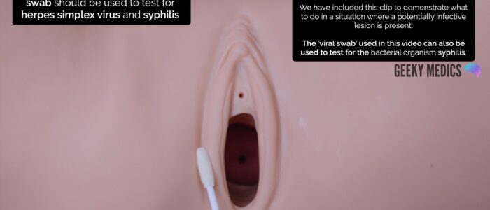 Swab any vulval lesions
