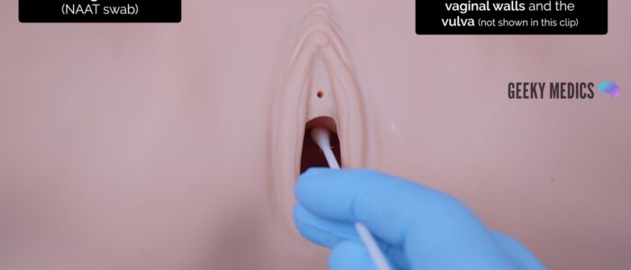 Take a vulvovaginal swab