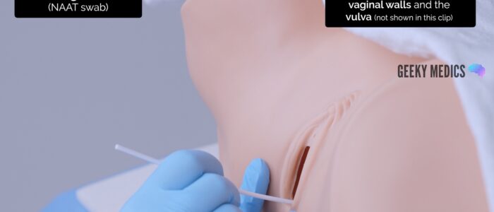 Take a vulvovaginal swab