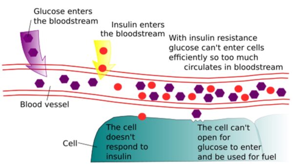 Schematic diagram showing effects of insulin resistance