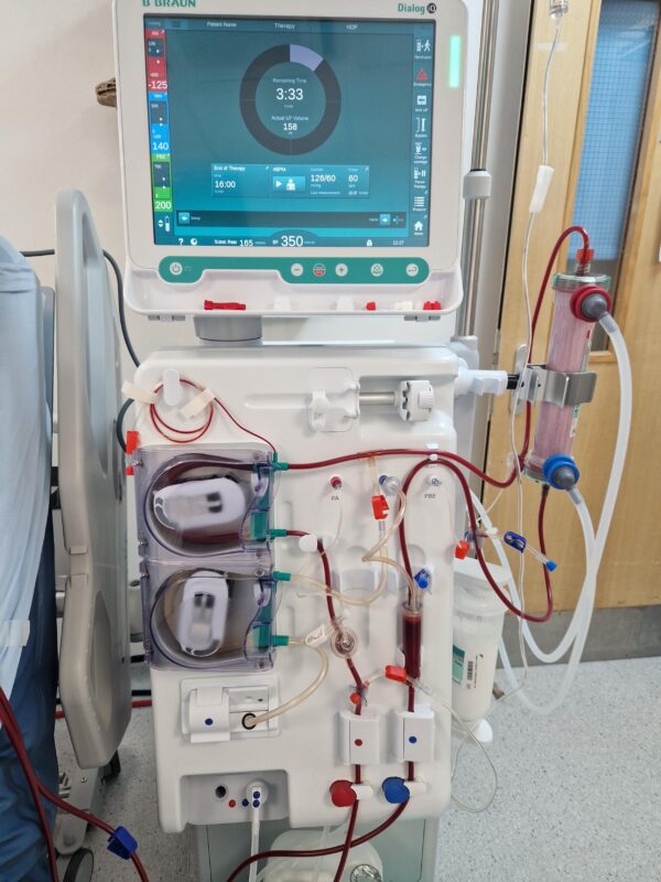 A haemodialysis machine