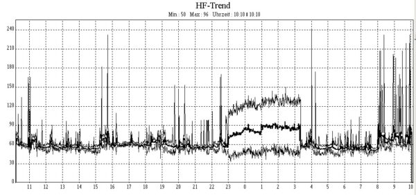 Heart rate diagram of a Holter recording report showing an episode of paroxysmal atrial fibrillation (23:00 - 03:20) 